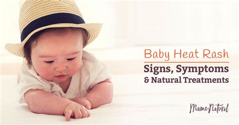Baby Heat Rash Signs Symptoms And Natural Treatments Baby Heat Rash