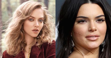 10 Celebrities Who Have Struggled With Skin Issues Just Like You