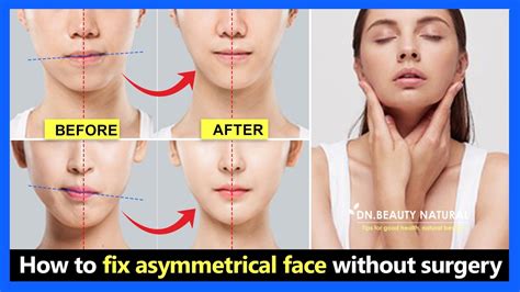Asymmetrical Jawlines Causes And Treatments Justinboey