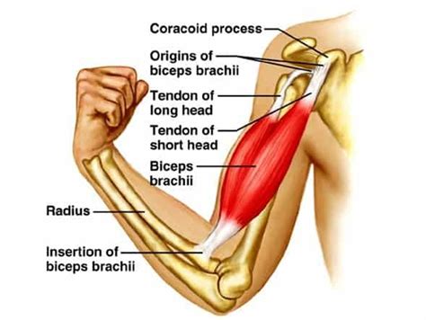 Intersection syndrome is a condition that affects the first and second compartments of the dorsal wrist extensors. Biceps tendonitis treatment with 3 exercises | Fast recovery