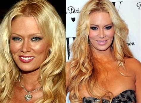 Jenna Jameson Before And After Plastic Surgery Celebrity Plastic