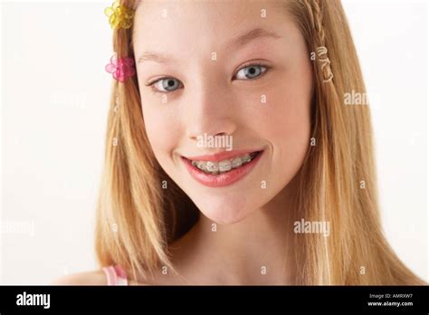 Teen Girl With Braces Closeup Banque De Photographies Et Dimages à