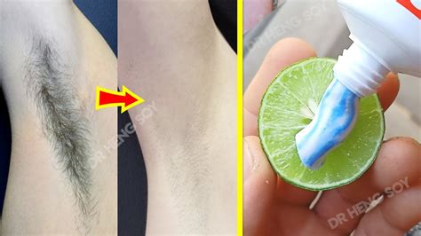 In Week Remove Unwanted Armpit Hair Permanently Works At Home