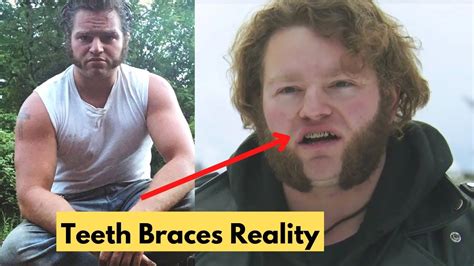 The Real Truth About Gabe Brown Braces Youtube