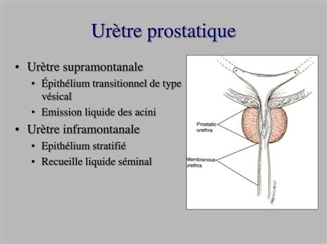 PPT Radio Anatomie De La Prostate PowerPoint Presentation ID 814235