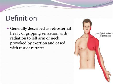 Angina Pectoris Definition Symptoms Treatment Video Lesson My Xxx Hot