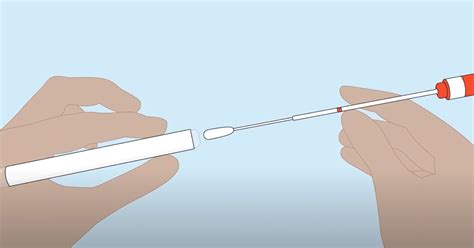 Understanding The Aptima Hpv Test A Comprehensive Guide Fpa Magazine