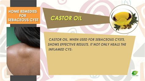 Home Remedies For Sebaceous Cyst Best Health Tips Educational