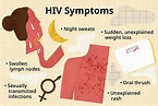 6 Signs of HIV to Know