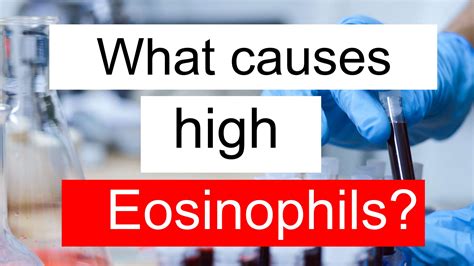 What Causes High Eosinophils And Low Segmented Neutrophils