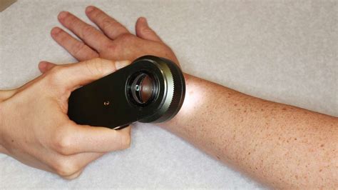 Cancer is tender and sensitive enough to make their leo partner feel guilty because of their nature, or leo could simply have difficulty being tender in the way cancer needs them to. Detecting skin cancer: Is a handheld magnifying tool ...