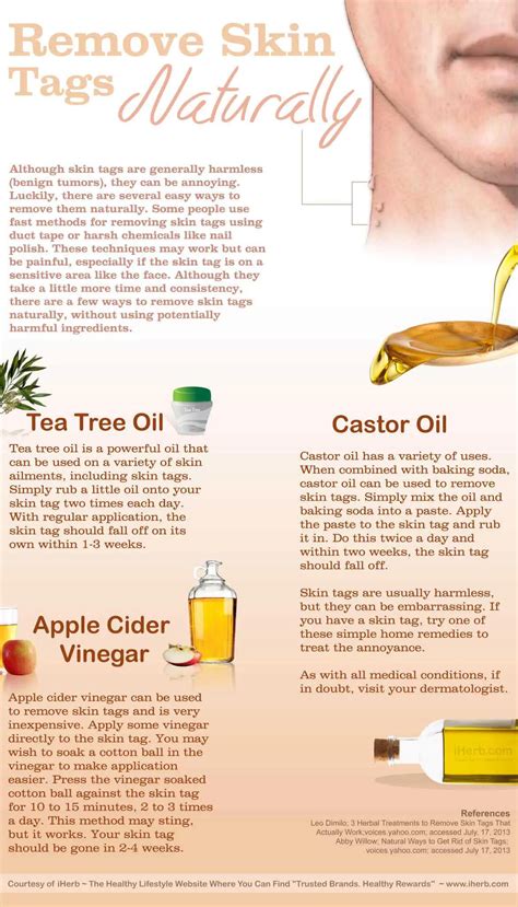 removing skin tags naturally 40 simple beauty infographics