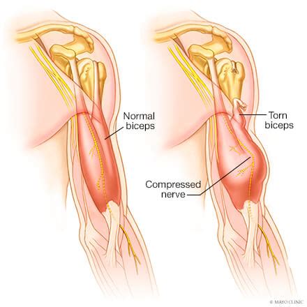 The nerves supply all the structures above and make them work. Shoulder Muscle And Tendon Anatomy / Muscles Of The ...