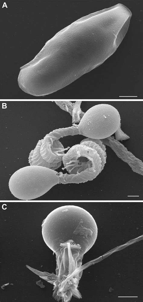 Electron Micrographs Of Isolated Hydra Nematocysts A Undischarged