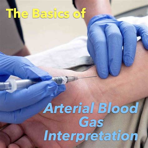 Arterial Blood Gas Interpretation Chart Arterial Blood Gas Icu