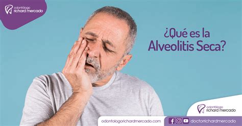 ¿qué Es La Alveolitis Seca Odontólogo Richard Mercado Arequipa Perú