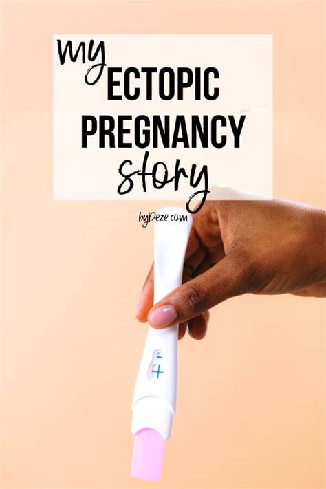 My Ectopic Pregnancy Story Bydeze