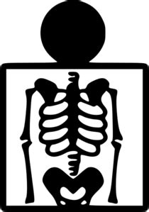 Over 41,664 xray pictures to choose from, with no signup we are online! X-ray Clip Art at Clker.com - vector clip art online, royalty free & public domain