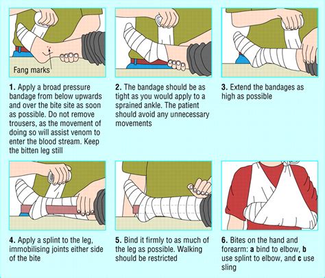 How To Do First Aid For Snake Bite Snake Poin
