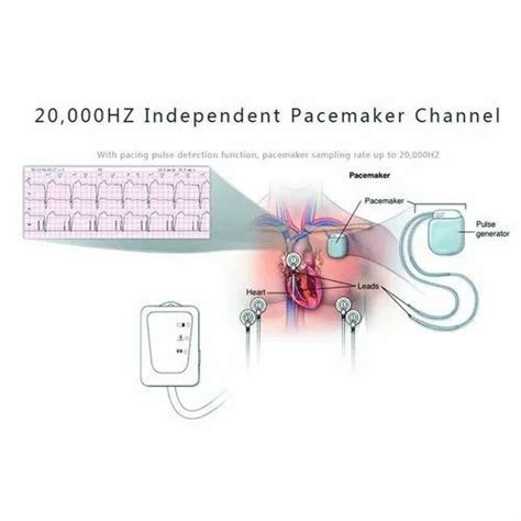 30 Holter Monitor 5 Lead Placement Diagram Wiring Database 2020 F74
