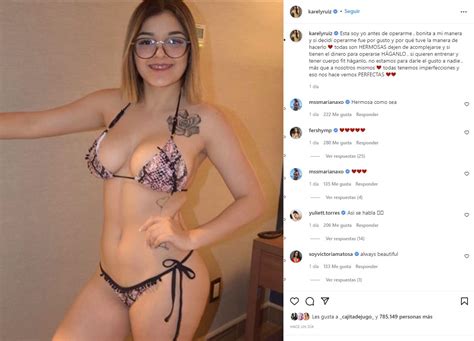 Así se veía Karely Ruiz antes y después de operarse FOTOS