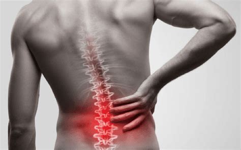 Lower Back Pain Due To Spinal Arthritis Non Surgical Pain Management