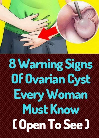 8 Warning Signs Of Ovarian Cyst Every Woman Must Know Ovarian Cyst Ovarian Cysts