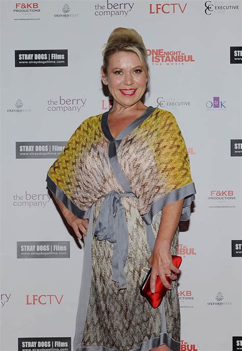 shameless actress tina malone has opened up about her cosmetic surgery