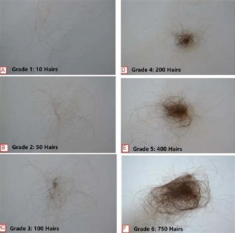 What Do 100 Strands Of Hair Look Like With Photo Hairstyle Camp