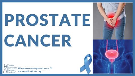Cancer Education Prostate Cancer Symptoms Early And Late Stages Prostate Cancer Therapy