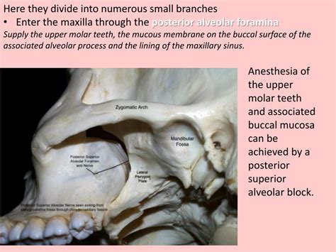 Ppt Infratemporal And Pterygopalatine Fossae Powerpoint Presentation