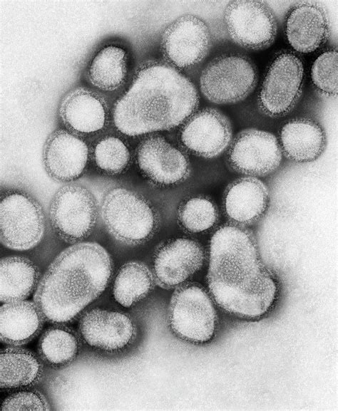 Influenza Virus Flu Under Microscope Micropedia