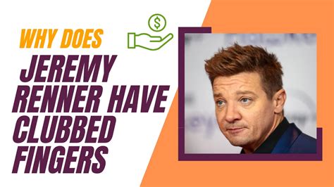 Why Does Jeremy Renner Have Clubbed Fingers