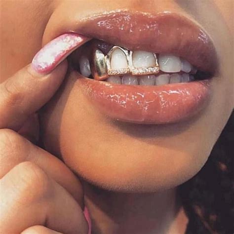 Pin On Tooth Gems