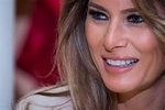 ¿Por qué Melania Trump debe estar varios días hospitalizada si tuvo una ...