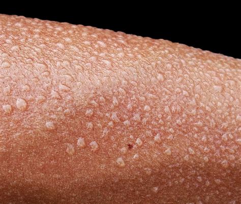 Verb (used without object), sweat or sweat·ed, sweat·ing. Crazy facts about body odor and sweat - Clubhouse News