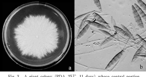 Figure 1 From Case Of Kerion Celsi Caused By Microsporum Gypseum