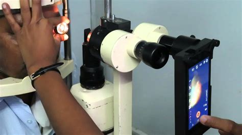This video will be an intro to using the slit lamp. Fundus photography with a Slit Lamp and an Aurolab Slit ...