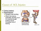 PPT - The Knee Joint PowerPoint Presentation, free download - ID:242910