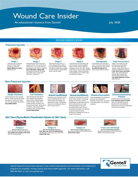 Wound Care Insider July 2020 Page2 Gentell