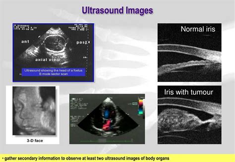 Ppt Medical Physics Ultrasound Powerpoint Presentation Free Download