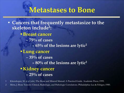 Ppt Metastatic Bone Disease And Multiple Myeloma Powerpoint
