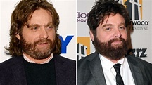 Zach Galifianakis slims down, shows off weight loss on 'Tonight ...
