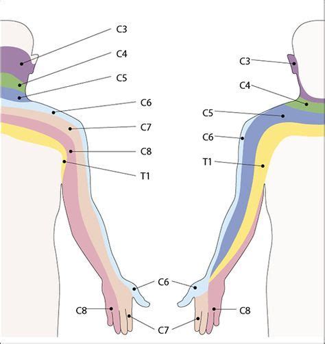 Dermatomes Of The Upper Limb The Stripes Are Areas Fed By Particular