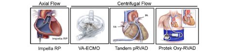 Right Ventricular Acute Mechanical Circulatory Support Devices