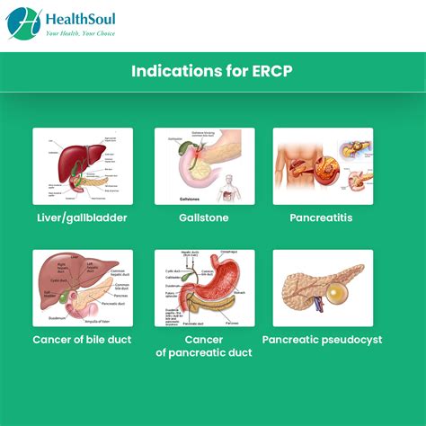 Icd 10 Code Procedure Code For Ercp Pancreatitis
