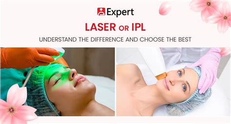 Laser Or Ipl Understand The Difference And Choose The Best Expert Centre
