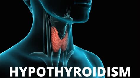 Thyroid Diet Foods To Avoid And 7 Best Natural Supplements For