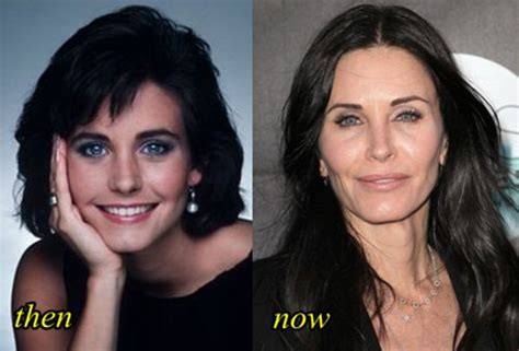 Courteney Cox Got Lip Injection And Facial Filler Plastic Surgery Feed