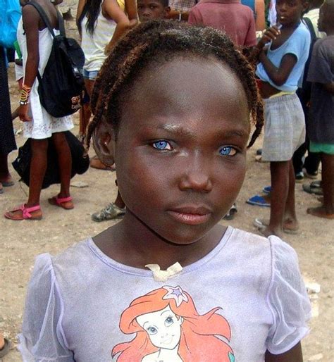 Негритянка С Голубыми Глазами Telegraph